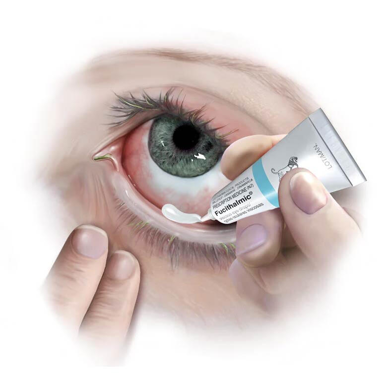 Medical Illustration